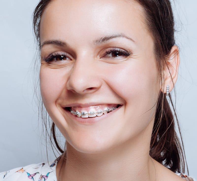 Woman smiling with braces